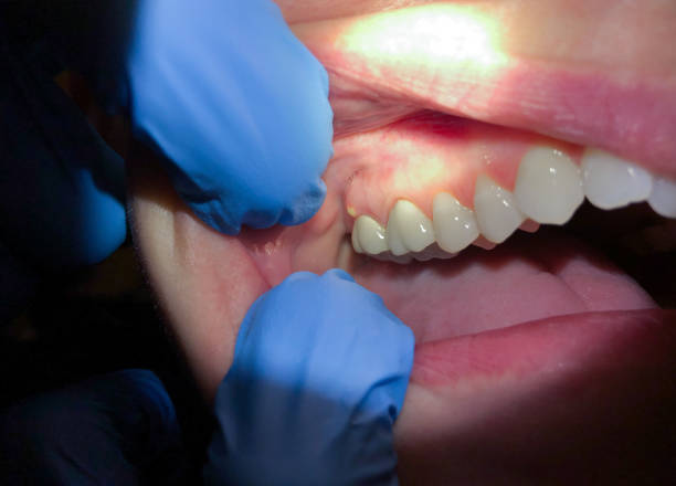 Best Cracked Tooth Emergency Dentist  in , GA